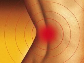 Osteokondroz ilə aşağı arxa ağrı